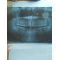 Appareils de radiographie panoramique dentaire Film